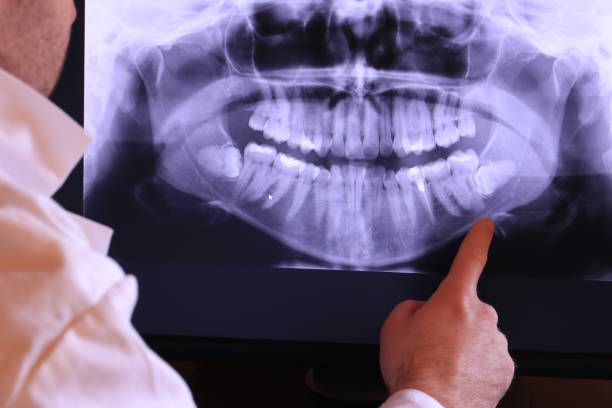 Best Broken Tooth Emergency  in Minot, ND